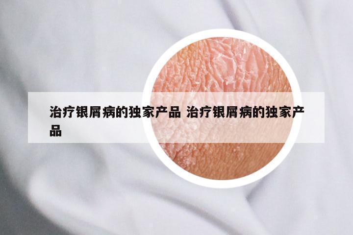 治疗银屑病的独家产品 治疗银屑病的独家产品