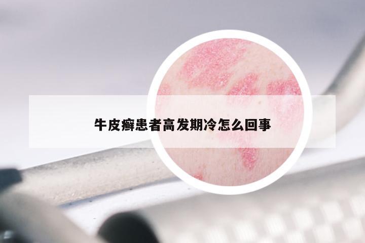 牛皮癣患者高发期冷怎么回事