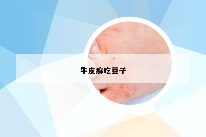 牛皮癣吃豆子