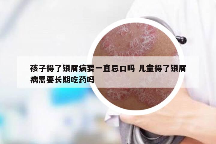 孩子得了银屑病要一直忌口吗 儿童得了银屑病需要长期吃药吗