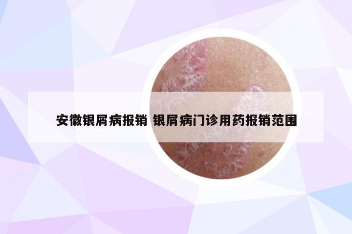 安徽银屑病报销 银屑病门诊用药报销范围
