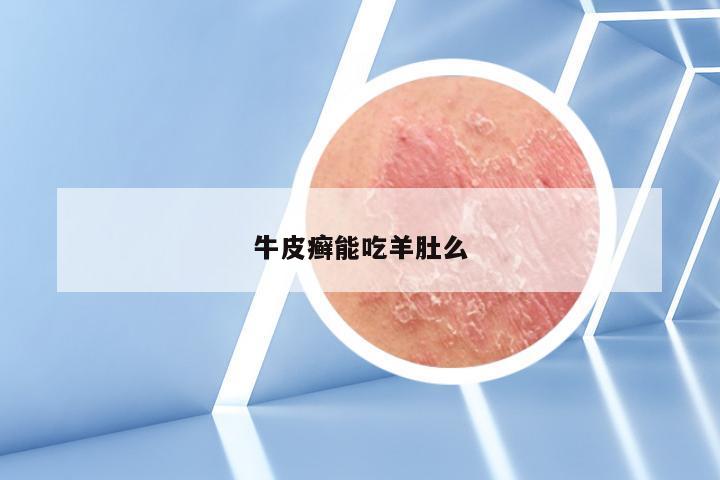 牛皮癣能吃羊肚么