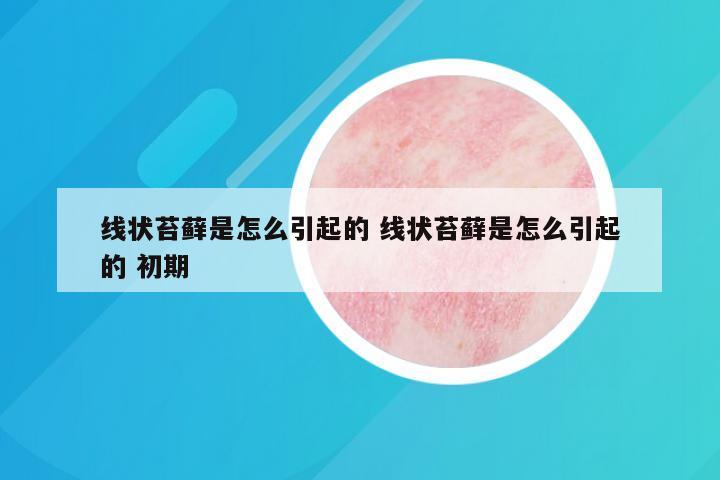 线状苔藓是怎么引起的 线状苔藓是怎么引起的 初期