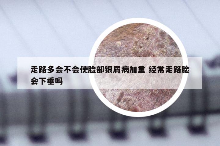 走路多会不会使脸部银屑病加重 经常走路脸会下垂吗