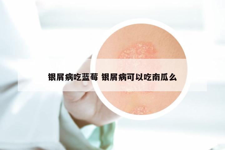 银屑病吃蓝莓 银屑病可以吃南瓜么