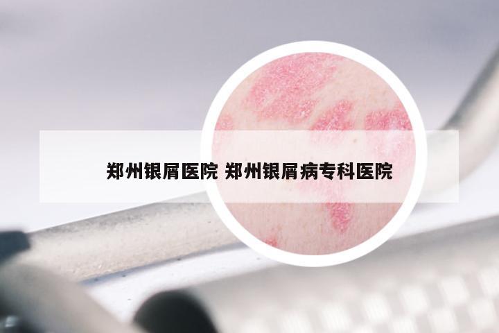 郑州银屑医院 郑州银屑病专科医院