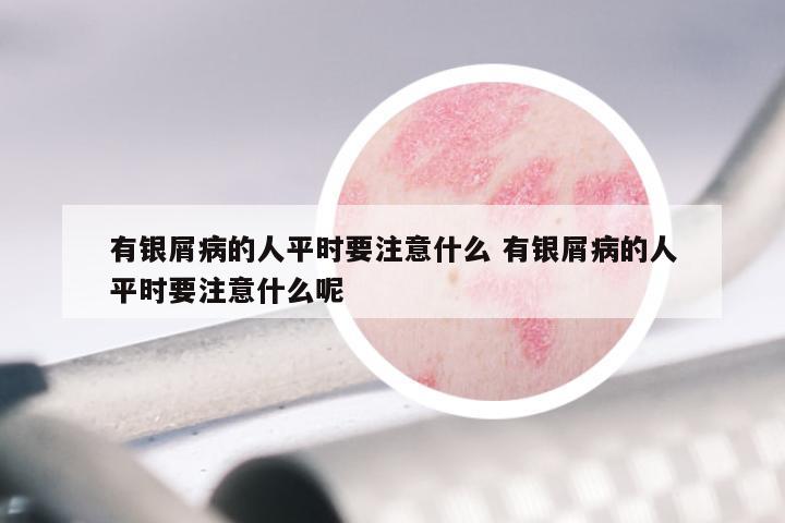 有银屑病的人平时要注意什么 有银屑病的人平时要注意什么呢