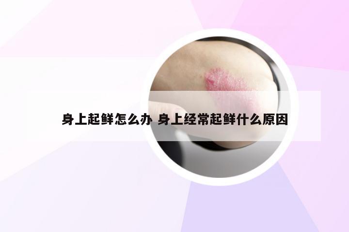 身上起鲜怎么办 身上经常起鲜什么原因