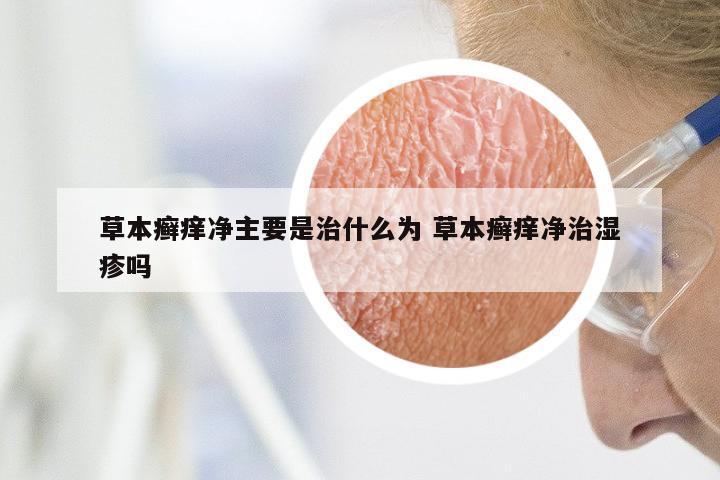 草本癣痒净主要是治什么为 草本癣痒净治湿疹吗