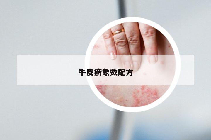 牛皮癣象数配方