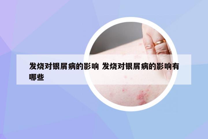 发烧对银屑病的影响 发烧对银屑病的影响有哪些