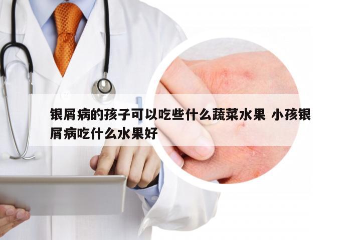 银屑病的孩子可以吃些什么蔬菜水果 小孩银屑病吃什么水果好