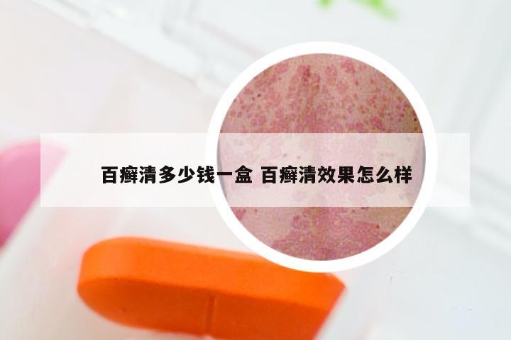 百癣清多少钱一盒 百癣清效果怎么样