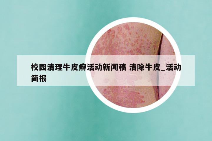 校园清理牛皮癣活动新闻稿 清除牛皮_活动简报