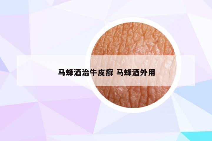 马蜂酒治牛皮癣 马蜂酒外用