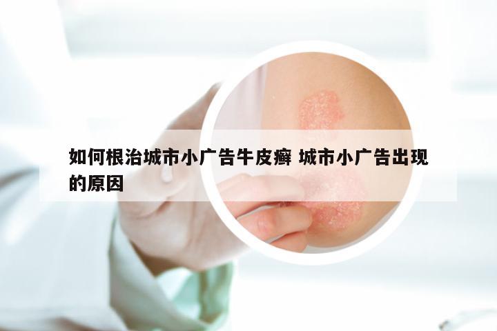 如何根治城市小广告牛皮癣 城市小广告出现的原因