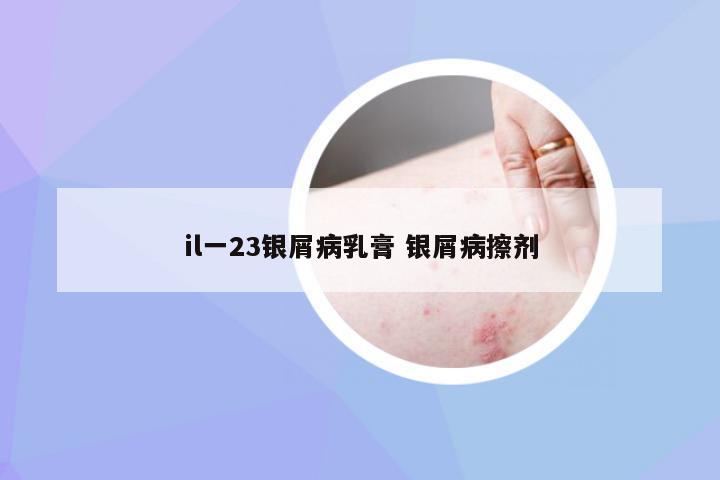 il一23银屑病乳膏 银屑病擦剂