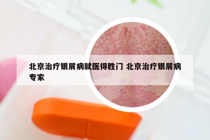 北京治疗银屑病就医得胜门 北京治疗银屑病专家