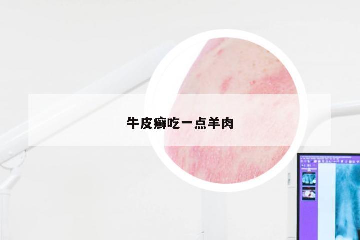 牛皮癣吃一点羊肉