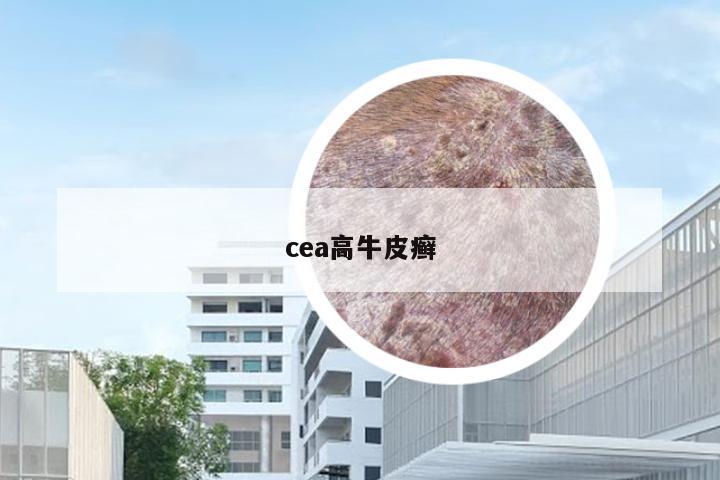 cea高牛皮癣