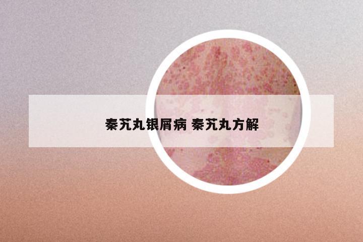 秦艽丸银屑病 秦艽丸方解