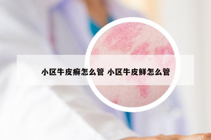 小区牛皮癣怎么管 小区牛皮鲜怎么管