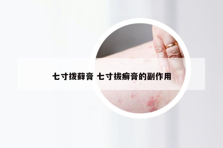 七寸拨藓膏 七寸拔癣膏的副作用