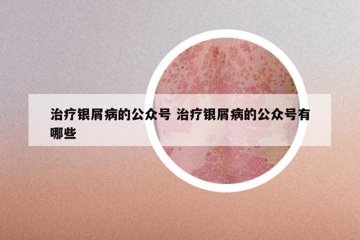 治疗银屑病的公众号 治疗银屑病的公众号有哪些