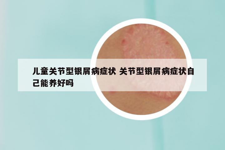 儿童关节型银屑病症状 关节型银屑病症状自己能养好吗