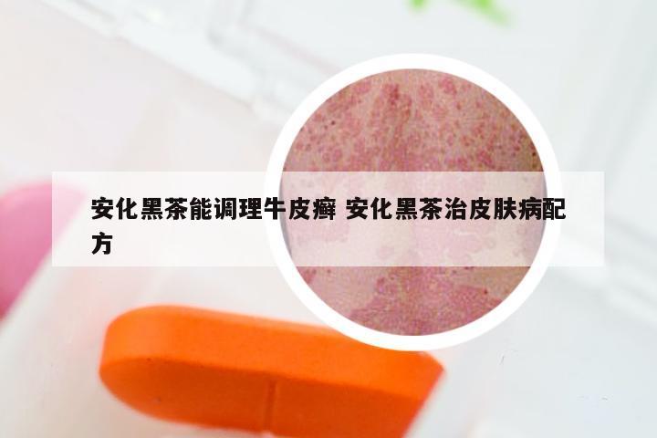 安化黑茶能调理牛皮癣 安化黑茶治皮肤病配方