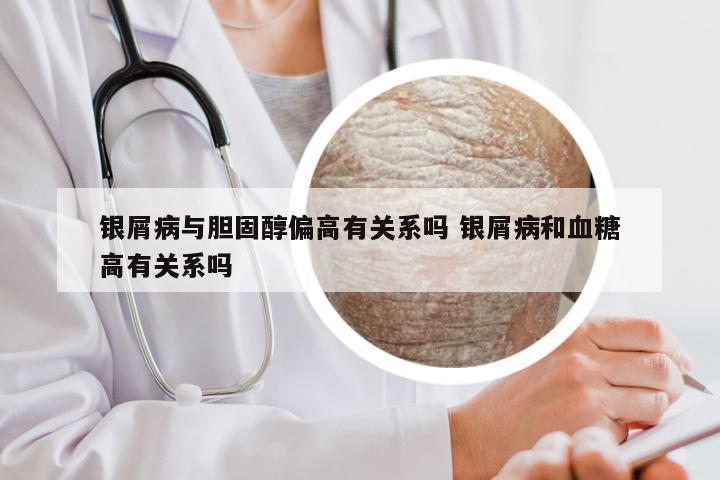 银屑病与胆固醇偏高有关系吗 银屑病和血糖高有关系吗