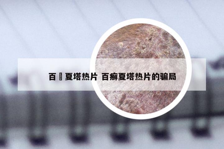 百廯夏塔热片 百癣夏塔热片的骗局