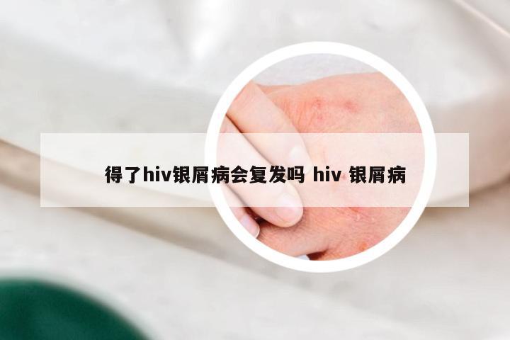 得了hiv银屑病会复发吗 hiv 银屑病