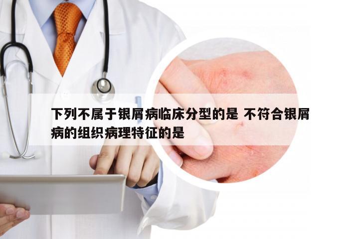 下列不属于银屑病临床分型的是 不符合银屑病的组织病理特征的是