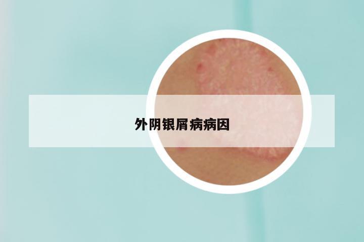 外阴银屑病病因