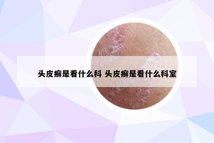 头皮癣是看什么科 头皮癣是看什么科室