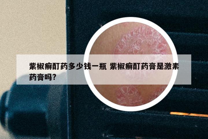 紫椒癣酊药多少钱一瓶 紫椒癣酊药膏是激素药膏吗?