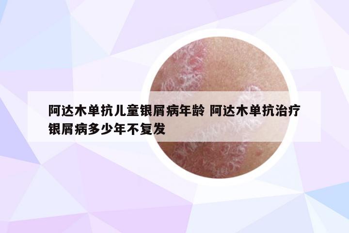 阿达木单抗儿童银屑病年龄 阿达木单抗治疗银屑病多少年不复发