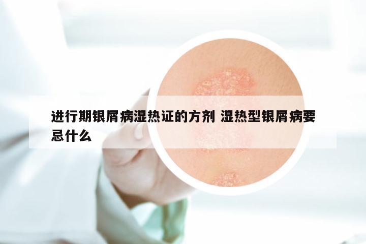 进行期银屑病湿热证的方剂 湿热型银屑病要忌什么