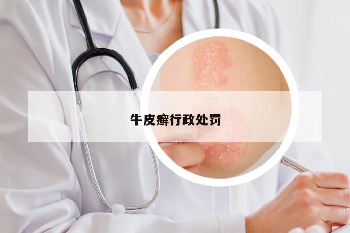 牛皮癣行政处罚