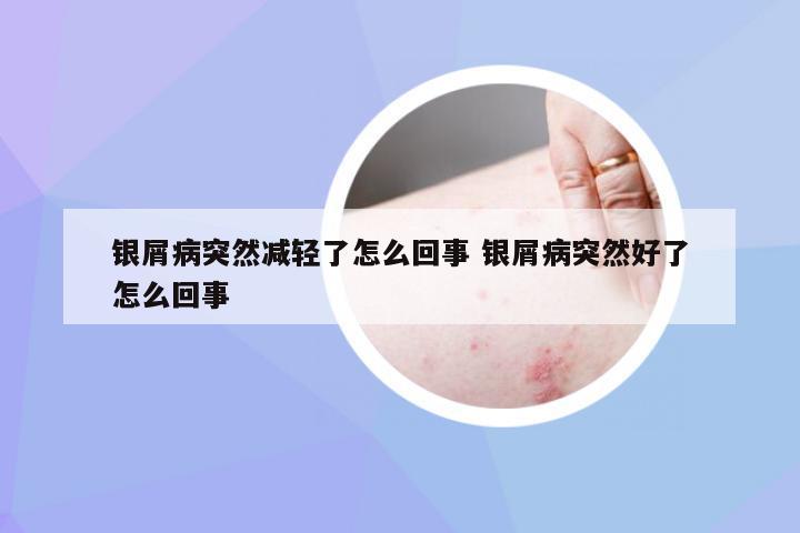 银屑病突然减轻了怎么回事 银屑病突然好了怎么回事