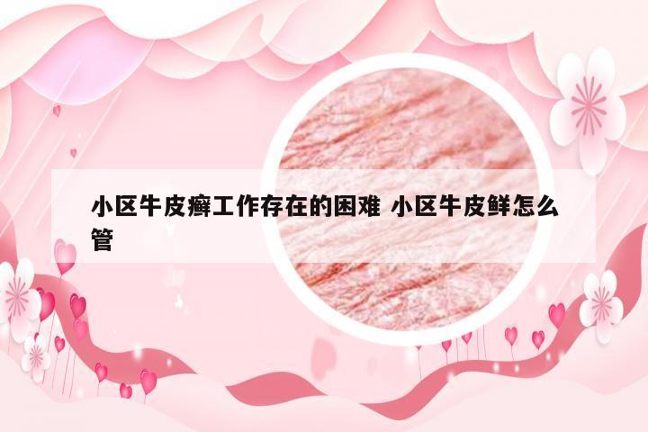 小区牛皮癣工作存在的困难 小区牛皮鲜怎么管