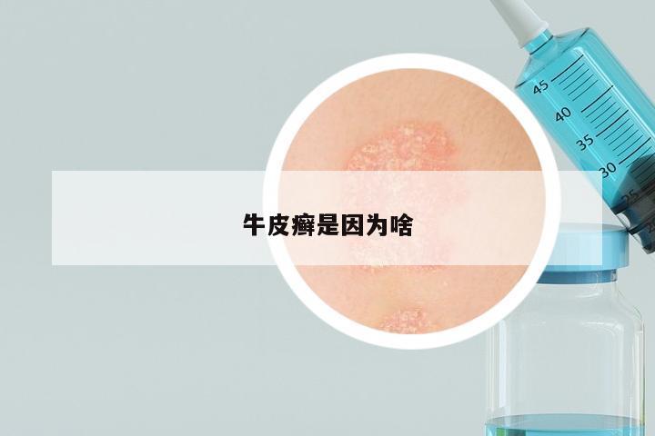牛皮癣是因为啥