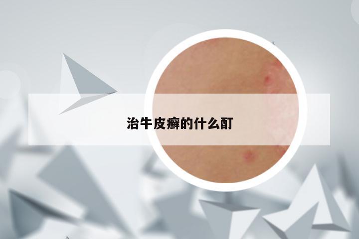 治牛皮癣的什么酊