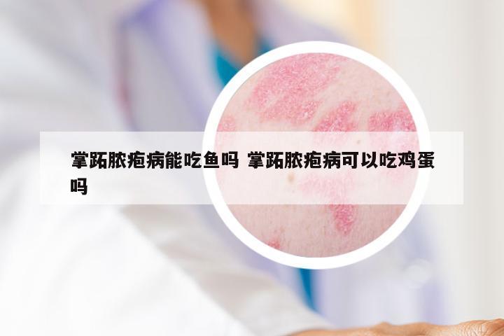 掌跖脓疱病能吃鱼吗 掌跖脓疱病可以吃鸡蛋吗