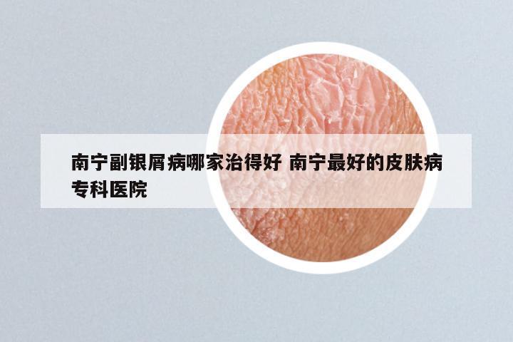 南宁副银屑病哪家治得好 南宁最好的皮肤病专科医院