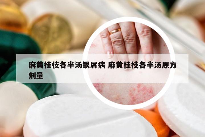 麻黄桂枝各半汤银屑病 麻黄桂枝各半汤原方剂量