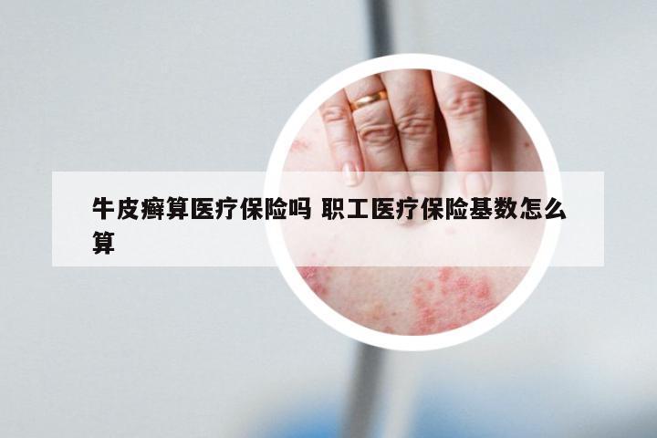 牛皮癣算医疗保险吗 职工医疗保险基数怎么算