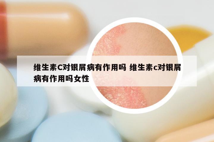 维生素C对银屑病有作用吗 维生素c对银屑病有作用吗女性