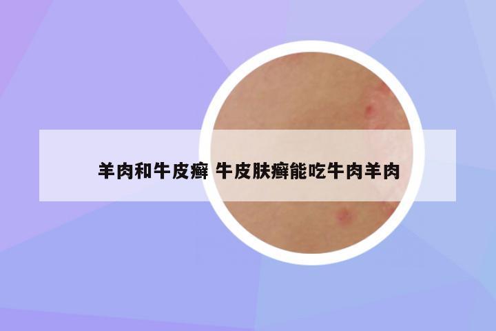 羊肉和牛皮癣 牛皮肤癣能吃牛肉羊肉